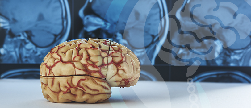 Imagem Neurocirurgia Vascular